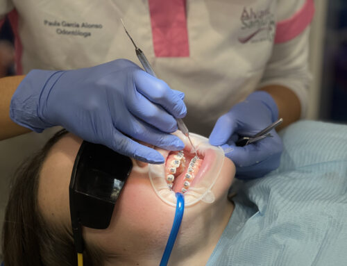 Beneficios de la ortodoncia para adultos en Clínica Dental Sanjurjo